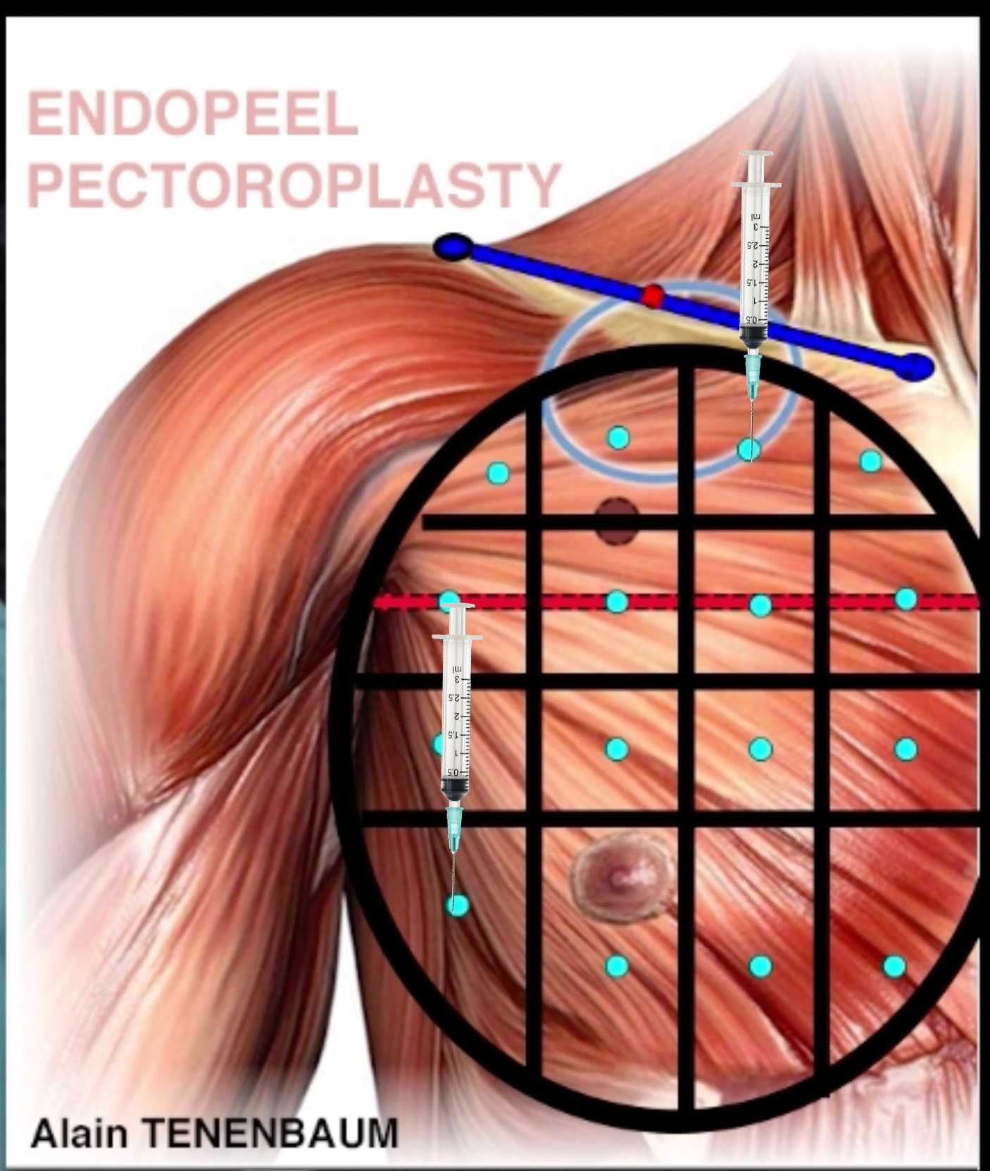Step8-Male Pectoral Vectors