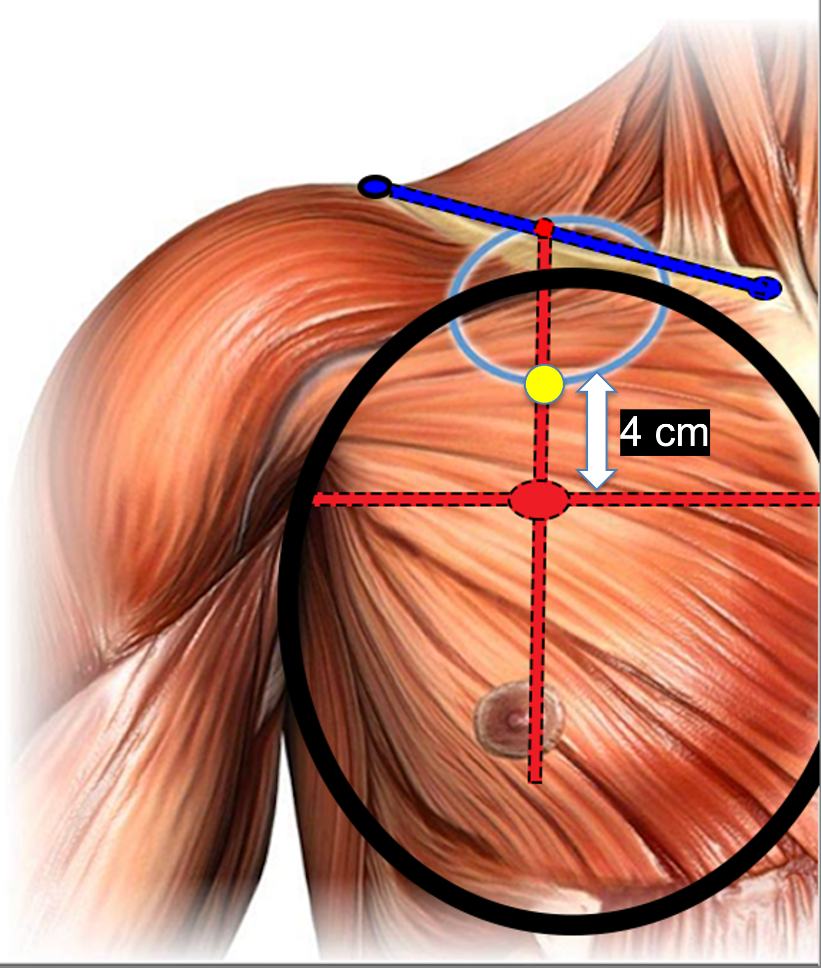 new maximum projection point