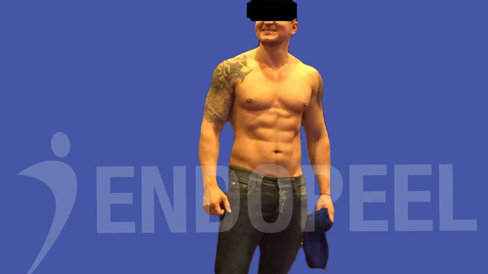 happy male patient after pectoral treatment