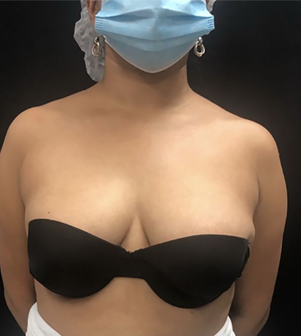 position of the patient