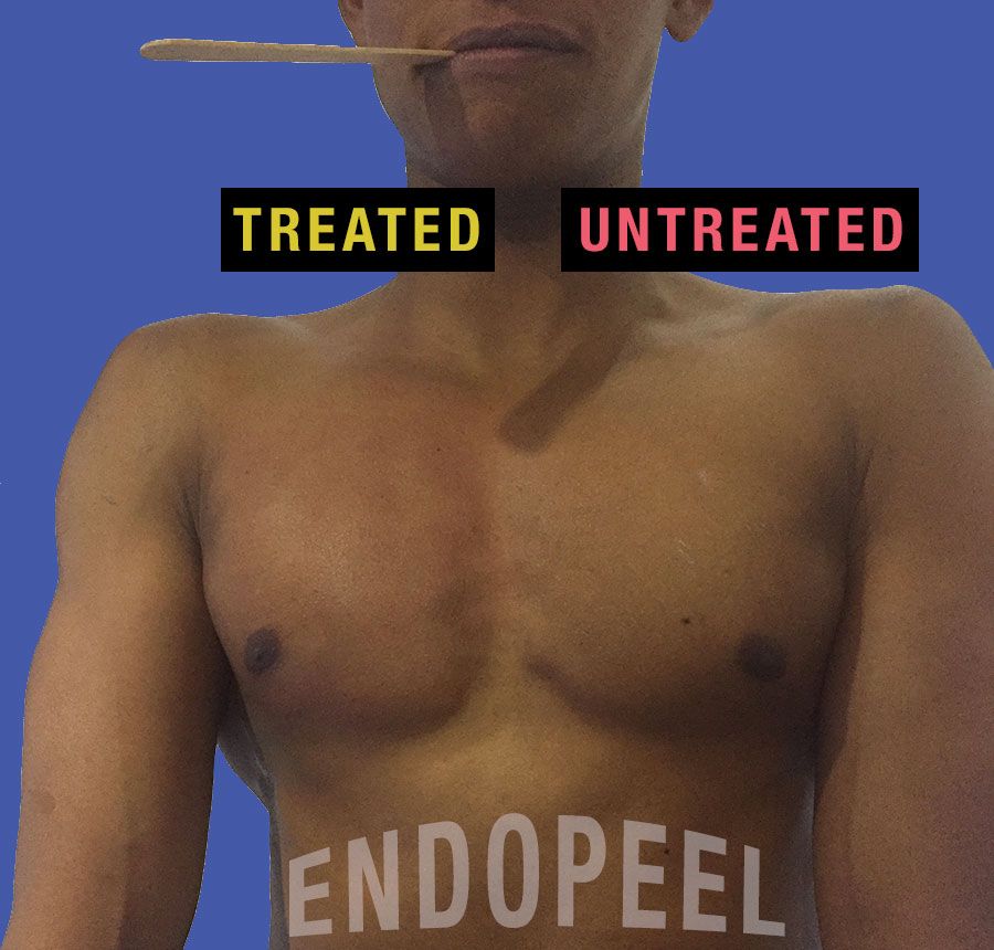 relaxation male pectoral endopeel